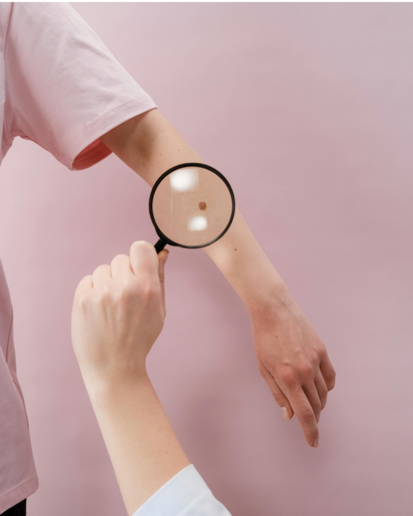 Dermatologue dépistage des cancers