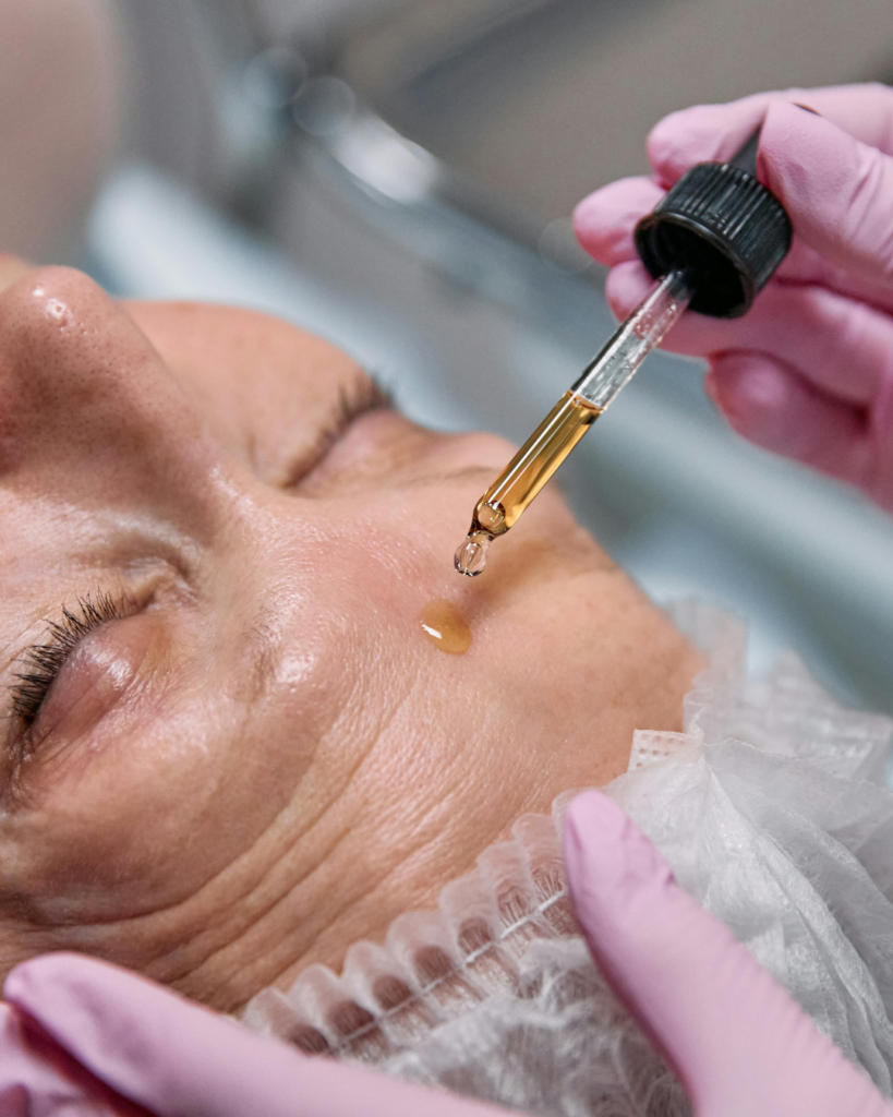 Un peeling effectué par un dermatologue vous apportera un éclat incroyable.