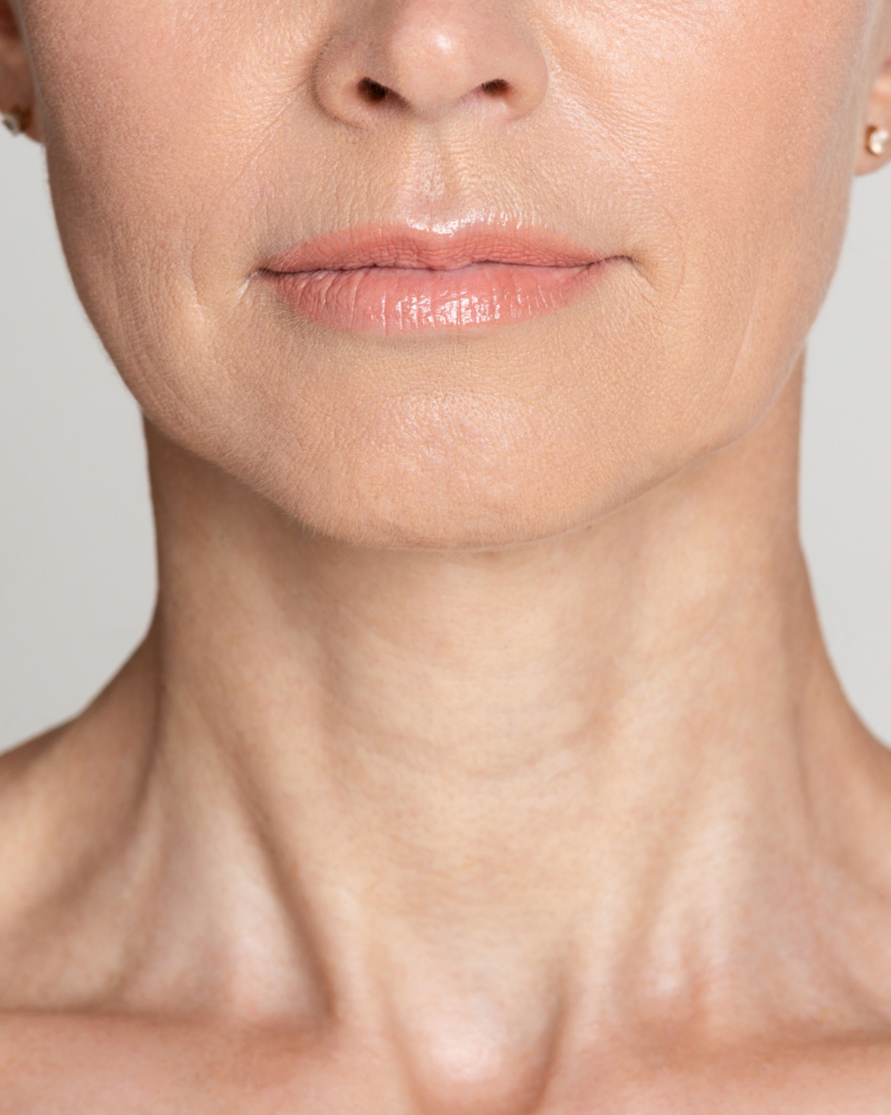 Types de peau et états de peau : les peaux matures