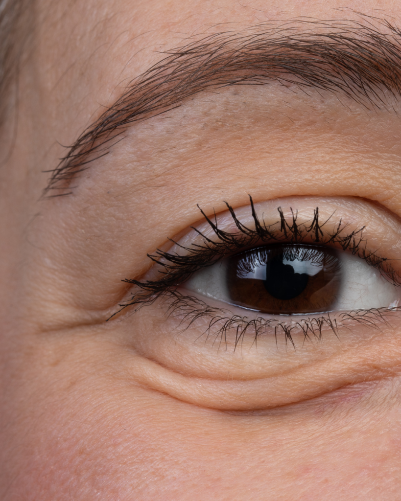 Beauty devices: que faire pour les poches
