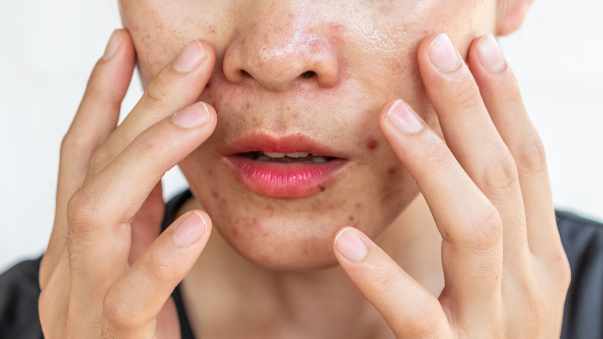 Routine Minimaliste Peau grasse : L'Essentiel à connaitre.
