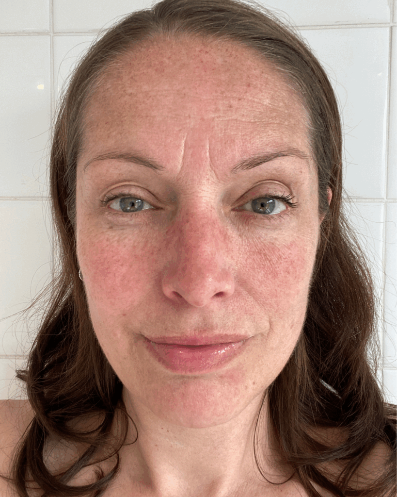 L'alpha arbutine dans une routine complète de soins anti-tâches.
