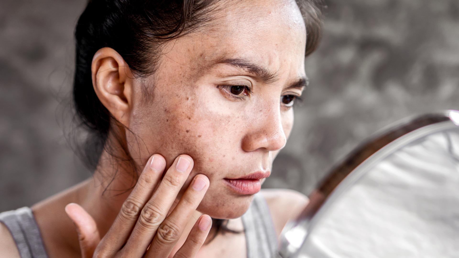 Routine anti-tâches en 5 étapes : Adieu à l’hyperpigmentation.