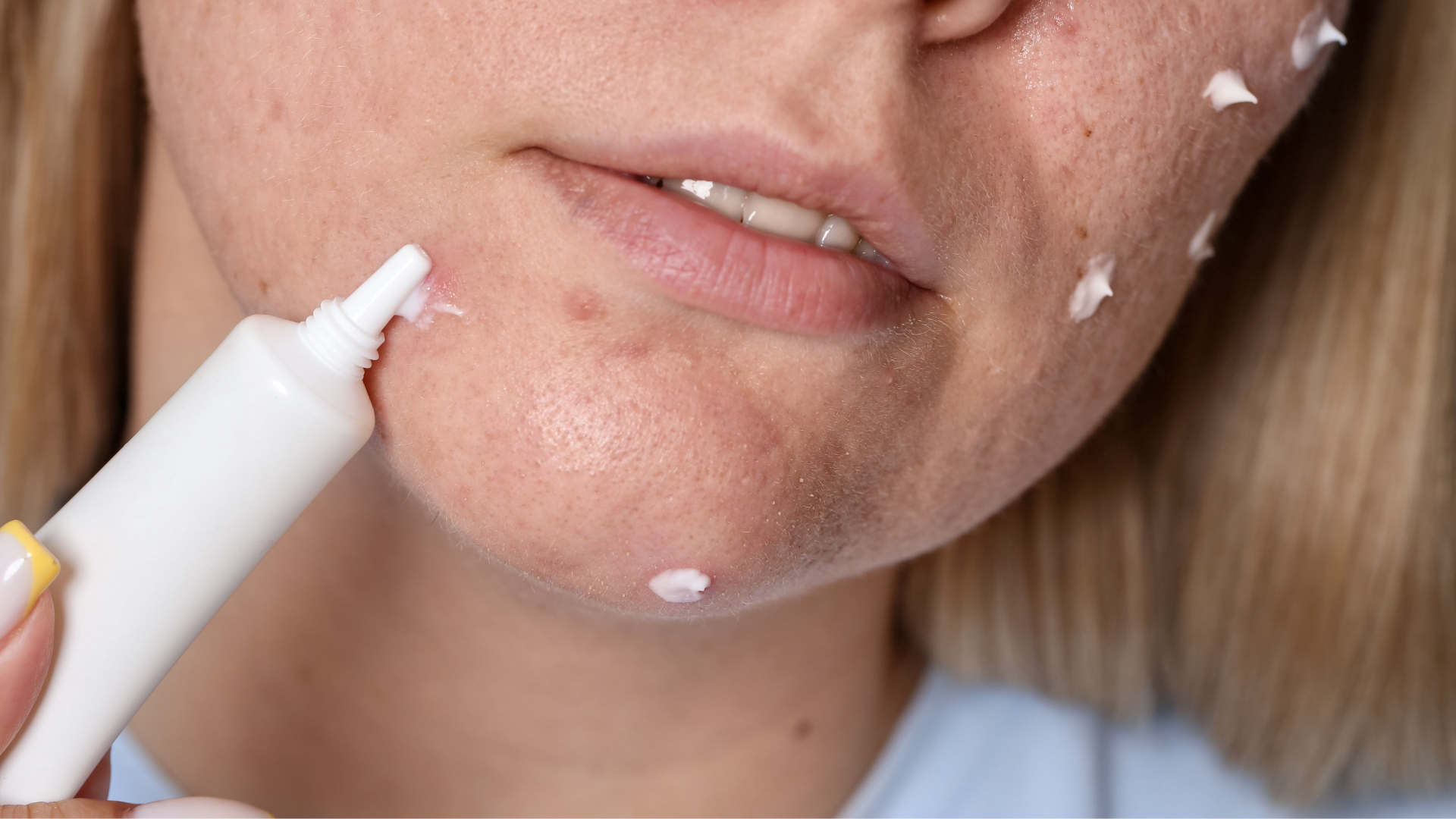 Soufre, l'Arme Secrète Anti-Imperfections
